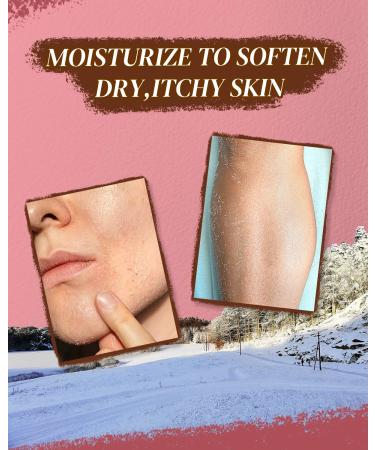 larosanna Australian Lanolin Cream,Natural Lanolin Cream for Itchy Dry Skin,Organic Lanolin Oil Moisturizer for Body and Face,3.53 fl oz - Buy Online on GoSupps.com