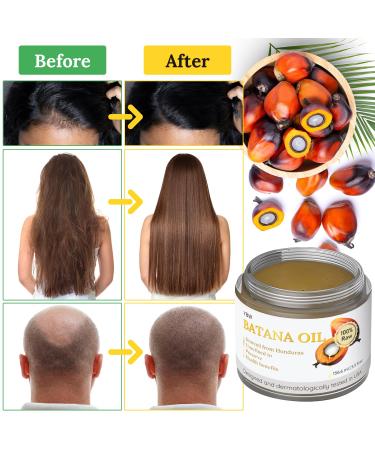 Dr. Sebi Batana Oil - 100% Natural & Organic Hair Growth Oil from Honduras | Enhance Thickness & Prevent Hair Loss for Men & Women - Buy Online on GoSupps.com