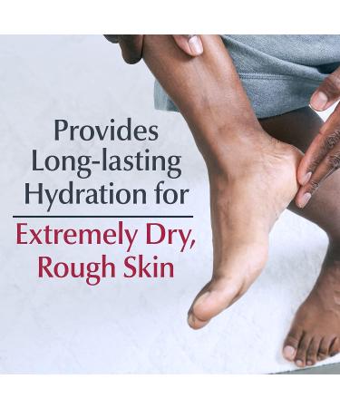 Eucerin Advanced Repair Leg and Foot Moisturizing Foam | 5 oz - Buy Online on GoSupps.com