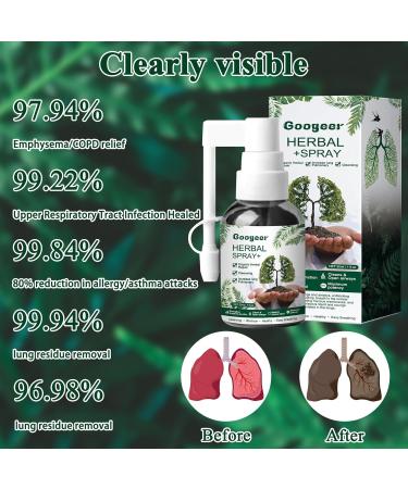 Buy 3 PCs Lung Cleaning Herbal Spray - RespiNature Herbal Lung Cleanse & Cleansing Spray for Optimal Lung Health - Buy Online on GoSupps.com