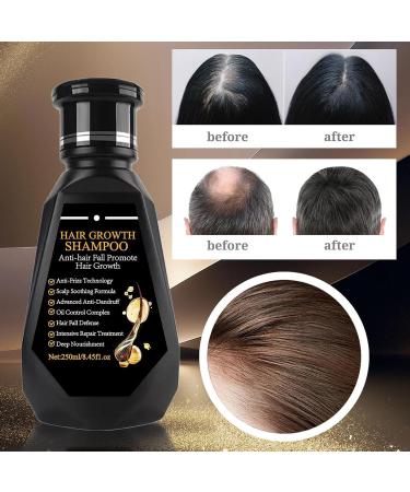GkgWuxf Hair Loss Shampoo 250ml Anti Thinning Shampoo Natural Strengthening Conditioner for Volumizing Deep Cleansing Soothing Scalp - Buy Online on GoSupps.com
