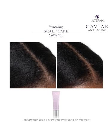 Alterna Renewing Scalp Care Treatment | Peppermint Lightweight Vegan Scalp Treatment for Dry Scalp | 74mL - Fast Absorbing International Shipping - Buy Online on GoSupps.com