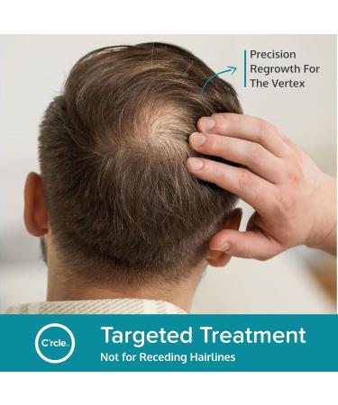 Regoxidine Men's 5% Minoxidil Foam 3-Month Supply - Restores Vertex Hair Loss, Promotes Hair Regrowth - Unscented Topical Treatment - 2.11oz (Pack of 3) - Buy Online on GoSupps.com