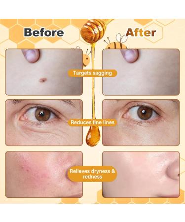 Bee Venom Facial Treatment Cream for Fine Lines & Improving Elasticity 2.12 OZ (Pack of 2) - Buy Online on GoSupps.com