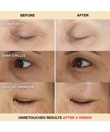 IT Cosmetics Confidence in an Eye Cream - Anti Aging Solution for Dark Circles & Crow's Feet - 48HR Hydration with Super Peptide Concentrate - Day & Night Formula (0.5 Fl. Oz) - Buy Online on GoSupps.com