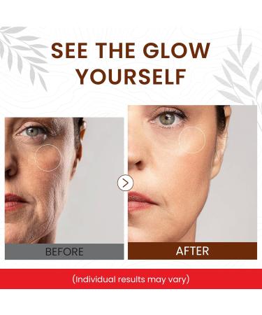 Rapid Dark Spot Remover for Face & Body Glow Boosting Serum | Vitamin C and Hyaluronic Acid | Age & Sun Spot Corrector Brown Spot Remover | Anti-Aging | Super Hydrating | Firming & Lifting - Buy Online on GoSupps.com