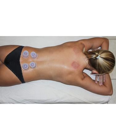 Cupping Therapy Set by DoSensePro - Arthritis Pain Relief & Anti-Aging Massage Cups - 6 Silicone Vacuum Cups for Cellulite Reduction - Relaxation Gift - Buy Online on GoSupps.com