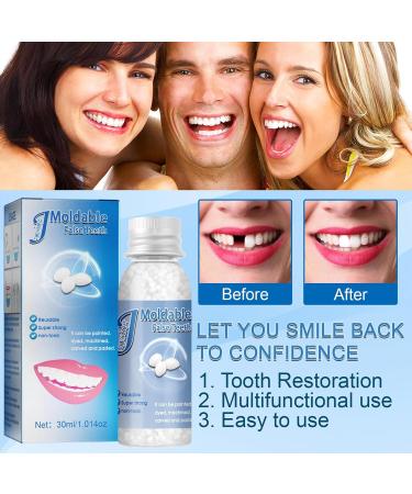 Grgowe Dental Adhesive & Temporary Dental Repair Kit for Provisional Dentures | Tooth Repair Set & Prosthesis Materials - Buy Online on GoSupps.com