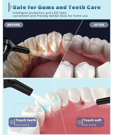 Stainless Steel Dental Plaque Remover with 5 Modes & LED Light - Rechargeable & 4 Heads Included - Buy Online on GoSupps.com