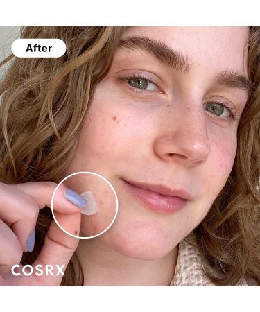 COSRX Acne Pimple Patch - 240 Count (Pack of 10) | Hydrocolloid | Blemish & Zit Cover Spot Stickers | for Face & Body | Non-Toxic, Cruelty-Free - Buy Online on GoSupps.com