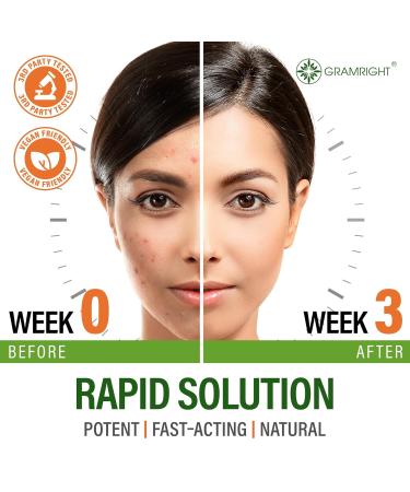 Perfect Skin Acne Pills - Clear Skin Supplement with Niacinamide Probiotic Zinc & Vitamin A - Anti Acne Vitamins for Teens Men & Women - Support for Face & Back Acne Acne Scars - 60 Capsules - Buy Online on GoSupps.com