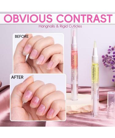 Lot de 2 stylos huile pour cuticules pour le soin des ongles huile pour cuticules pour ongles avec lime ongles huile ongles pour viter les fissures s ches et les ongles suspendus nutrition Saveur ananas et p che - Buy Online on GoSupps.com