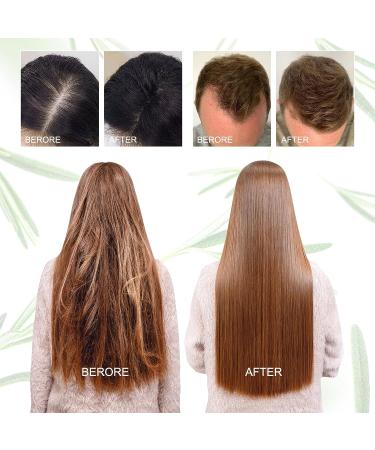 100% Pure Rosemary Oil for Hair Growth, Skin Care & Scalp Nourishment - 3.5 Oz Bottle - Aromatherapy & Hair Loss Treatment for Men & Women - Buy Online on GoSupps.com