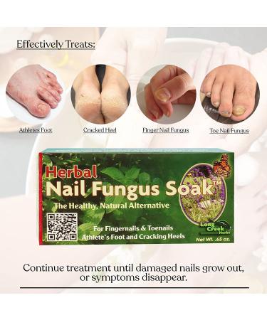 Nail Fungus Soak - Natural Solution for Toenail and Fingernail Issues - Combat Cracked Heels and Athlete's Foot - Hypoallergenic Fungus Remover for Feet and Hands - Buy Online on GoSupps.com