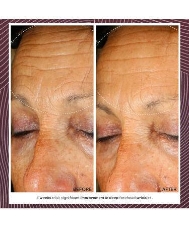 Droplette Retinol Renewer Capsules - Reduce Crease Lines & Revitalize Skin with Arbutin Rose Oil & Collagen (30 Count) - Shop Internationally - Buy Online on GoSupps.com