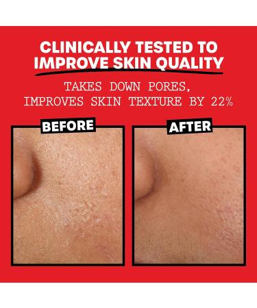 THAYERS Witch Hazel Lavender Alcohol-Free Toner - 12 Fl Oz | Natural Skin Care for All Skin Types - Buy Online on GoSupps.com