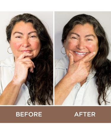 Fake Bake Vitiligo Vanquish Camouflage Kit - Long Lasting Concealer for Skin Depigmentation - Natural Color Customization for Women & Men - Buy Online on GoSupps.com