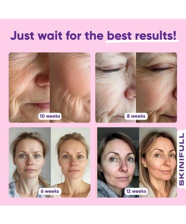 Skinifull Hyaluronic Moisturizing Face Cream - Buy Online on GoSupps.com