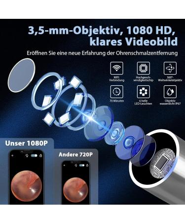 Outact WiFi 1080p HD Ear Wax Removal Otoscope - IP67 Waterproof Ear Cleaner for iPhone iPad & Android - 6-Part Ear Lobes Black - Buy Online on GoSupps.com