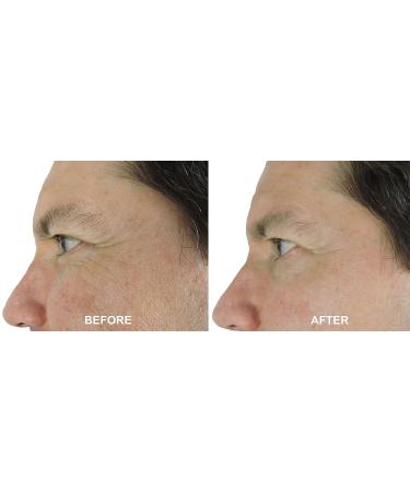 Argireline Copper Peptide Serum | Wrinkle Reduce Booster with Snap-8 & Matrixyl 3000 | No Needle Alternative | 0.5 oz - Buy Online on GoSupps.com