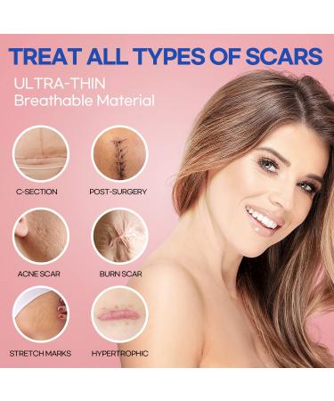 Silicone Scar Removal Sheets for Old & New Scars - 6 Sheets (2 Sizes) - Effective Treatment - Diverse Scars - 5.9 x 1.57 & 2.95 x 1.57 - Buy Online on GoSupps.com