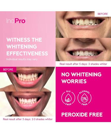 InoPro Peroxide-Free Teeth Whitening Strips - Gentle Whitening for Sensitive Teeth - Deep Stain Removal - 14 Treatments - Buy Online on GoSupps.com