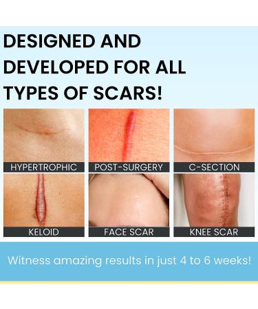 Scarguard Scar Treatment with Silicone & Vitamin E - 0.5 oz - For New & Old Scars - Buy Online on GoSupps.com