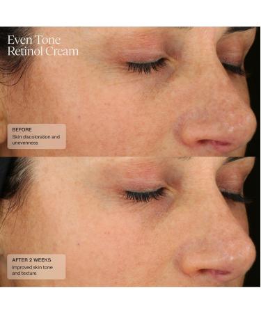 Buy Sent Even Tone Fast-Acting Retinol Cream - Diminish Dark Spots & Fine Lines - 1 Fl Oz - International Shipping Available - Buy Online on GoSupps.com