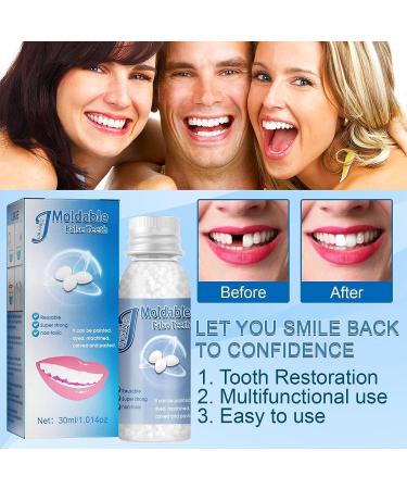 Temporary Adhesive Kit for Missing Denture Teeth Repair - Smile Confidently with False Teeth Straightener (30g, White) - Buy Online on GoSupps.com