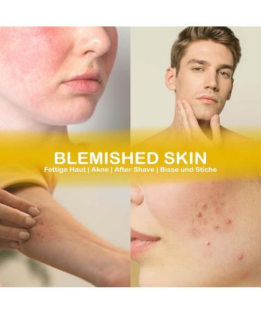 Organic Hamamelis Water - Face Tonic 500ml | Witch Hazel Cleaner for Greasy & Sensitive Skin | Pore Minimizer & Impurity Eliminator - Buy Online on GoSupps.com