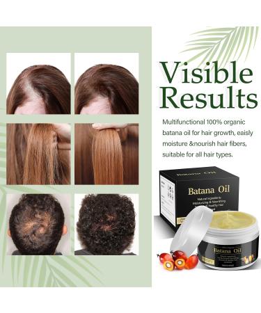 Natural Dr Sebi Batana Oil from Honduras - Promote Hair Growth Prevent Hair Loss Suitable for All Hair Types - Buy Online on GoSupps.com