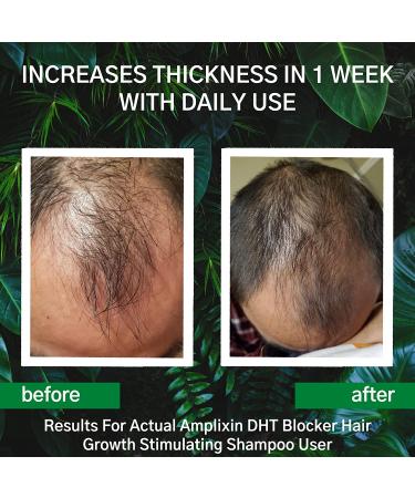 DHT Blocker Hair Growth Shampoo by Amplixin | Clinically Proven Treatment for Thinning Hair | Sulfate-Free Formula for Healthy Hair Regrowth - Buy Online on GoSupps.com