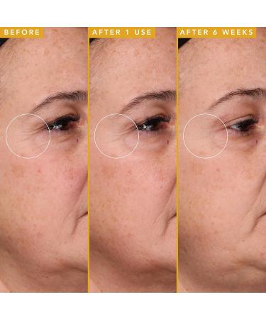 Farmacy Hyaluronic Acid Serum - Anti-Aging Hydrating Face Serum for Youthful Skin & Wrinkle Reduction (5ml) - International Shipping Available - Buy Online on GoSupps.com