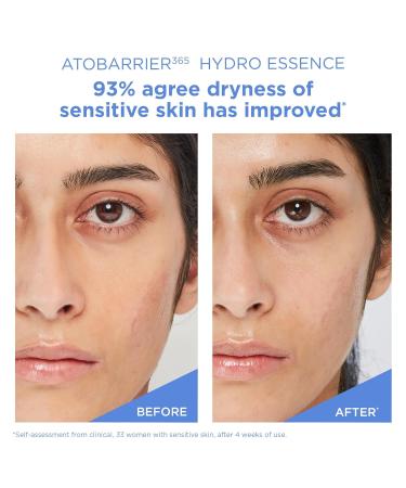 AESTURA ATOBARRIER365 Hydro Essence with Hydrating Amino Acids for Face | Lightweight Formula Deep Hydration Suitable for Dry & Sensitive Skin Non-Comedogenic 100ML / 3.38 fl. oz. 3.38 Fl Oz (Pack of 1) - Buy Online on GoSupps.com