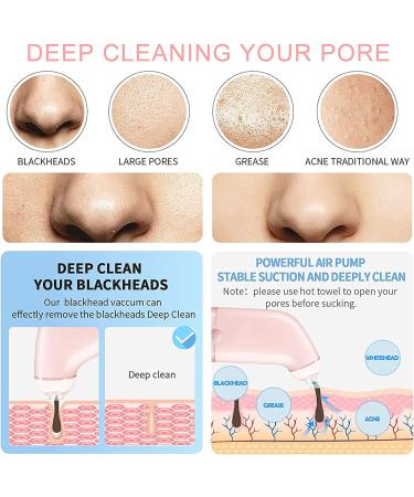 Blackhead Remover Pore Vacuum Cleaner - USB Rechargeable Electric Suctioner with 3 Probes, Upgraded Facial Pore Cleaner in Light Pink - Buy Online on GoSupps.com