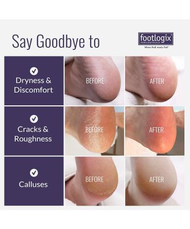 Foot Care Callus Softener Combo Footlogix Spray & Double Sided File for Soft Smooth Heels | Best DIY Pedicure Exfoliator - Buy Online on GoSupps.com