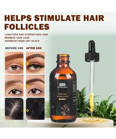 BuyBrilliance Rosemary Oil & Coconut Oil - Hair Growth Serum for Damaged Hair Reduces Hair Loss & Dry Scalp Eyebrow & Eyelash Growth - 2oz - Buy Online on GoSupps.com
