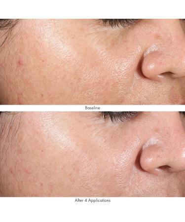 Obagi Medical Revivify Multi-Acid Facial Peel - Shop Internationally for Radiant Skin - Buy Online on GoSupps.com