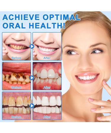 Hydroxyapatite Toothpaste 9.9% (2PCS) Nano Hydroxyapatite Toothpaste for Enamel Protection and Tooth Strengthening Gentle Mint Fresh Breath Daily Use for Oral Health - Buy Online on GoSupps.com