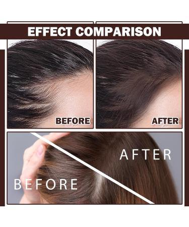 Root Cover Up Powder for Hair Loss & Thinning - Long Lasting Concealer for Bald Spots & Beard Line | International Shipping - Buy Online on GoSupps.com