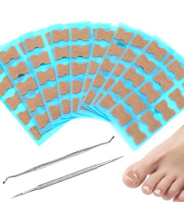 SANNIX Ingrown Toenail Tool Set with 100 Pieces Correction Patches Curved Double Toenail File & Ingrown Nail Cleaner for Men and Women