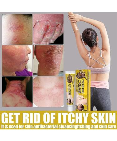 Revitaskin Herbal Eczema Psoriasis Cream - Eczema Relief for Adults (2 pcs) - Buy Online on GoSupps.com