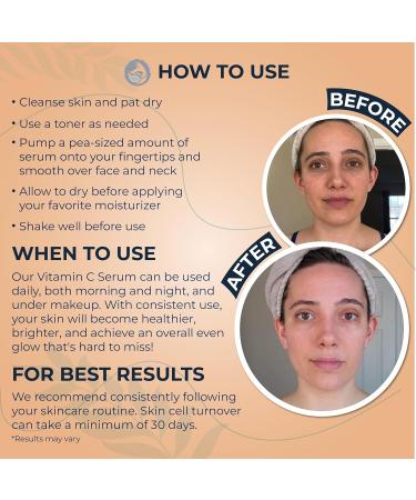 Vitamin C Serum for Face with Hyaluronic Acid Best Anti Aging Serum on Face Skin Eye - Vegan Amino Complex - Natural & Organic - Anti Wrinkle Fine Lines Fades Age Spots - 30ml by Foxbrim - Buy Online on GoSupps.com