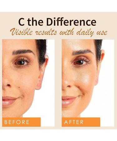 Vitamin C Hyaluronic Acid & Retinol Face Serum - 30ml | Brightening Hydrating & Pore-Reducing Moisturizer for Smooth Skin - Buy Online on GoSupps.com