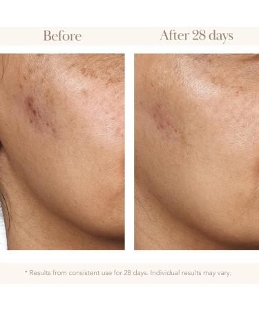 Vitamin C Gold C Concentrate Serum 45 ml - Buy Online on GoSupps.com