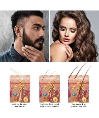  YHNMMNO Rosemary Oil for Hair & Scalp - Natural Hair Growth Oil with Organic Rosemary Oil Castor Oil Almond Oil & Argan Oil - 60ml - Buy Online on GoSupps.com