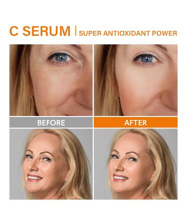 Super Vitamin C Serum for Women 50+: Hyaluronic Acid & Peptides - Brightening Dark Spots & Reducing Wrinkles - Buy Online on GoSupps.com