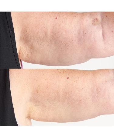 Perricone MD Hyaluronic Intensive Body Therapy 6 oz. | High Potency Classics - Buy Online on GoSupps.com