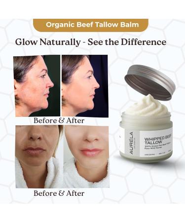 Beef Tallow Moisturizer - 100% Grass-Fed Whipped Beef Tallow For Face & Body - Organic & Natural Formula With Honey & Jojoba Oil | For Dry & Sensitive Skin - 2oz - Buy Online on GoSupps.com