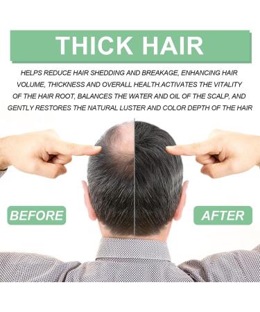Renew Hair X Renew Hair X Roll-on Hair and Beard Regrow Hair Regrowth Treatment for Hair Loss Hair and Beard Regrowth Roll-on Serum for Men and Women (1 pc) - Buy Online on GoSupps.com